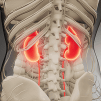 Terapia asequible con células madre para la insuficiencia renal en México